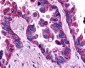 EDNRA / Endothelin A Receptor Antibody (Extracellular Domain)